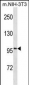 ATP1A1 Antibody(Ascites)