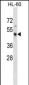 KCNJ3 Antibody (C-term)(Ascites)