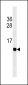 Cardiac FABP Antibody(Ascites)