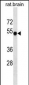 RAT Camk2a Antibody (ascites)