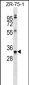 MBP Antibody (Ascites)