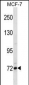 FCRL5 Antibody (Center)