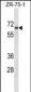 TM117 Antibody (C-term)