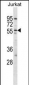 HCRTR2 Antibody (Center)