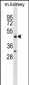 HCRTR2 Antibody (Center)