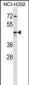 AKR1C4 Antibody (N-term)