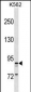 TAS1R3 Antibody (N-term)