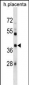 SIAH1 Antibody (Center)