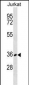 CD226 Antibody (C-term)