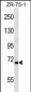 TEC Antibody (N-term)