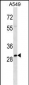 THOC4 Antibody (Center)