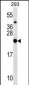 RPL9 Antibody (C-term)