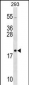 RPL26 Antibody (C-term)