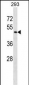 ZNF24 Antibody (Center)