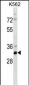 PRPS2 Antibody (Center)