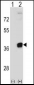 PRPS2 Antibody (Center)