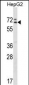 MED26 Antibody (Center)