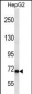 CHD1L Antibody (Center)