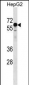 KLHL25 Antibody (N-term)