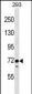 EPS8L1 Antibody (N-term)