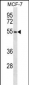 ARMCX1 Antibody (Center)