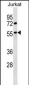 GPRC5B Antibody (C-term)