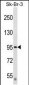DTX3L Antibody (Center)