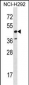 RAD52 Antibody (C-term)