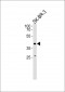 ELK3 Antibody (N-term)