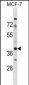 ZAR1 Antibody (Center)