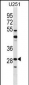 FOSL2 Antibody (C-term)