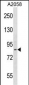 ADAM23 Antibody (C-term)