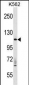 VPS11 Antibody (C-term)