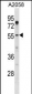 ASPSCR1 Antibody (N-term)