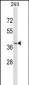 CCRL2 Antibody (Center)