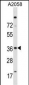 ISL2 Antibody (N-term)