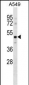 GPR37L1 Antibody (N-term)