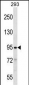 SLITRK2 Antibody (C-term)