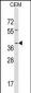 RAD52 Antibody (Center)