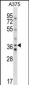 AVPR1A Antibody (C-term)