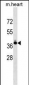 TNNT2 Antibody (Center)