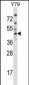 EPB49 Antibody (Center)