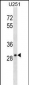 FAIM2 Antibody (Center)