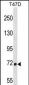 MARCH7 Antibody (N-term)