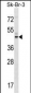 GPR87 Antibody (C-term)