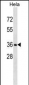 RNF34 Antibody (C-term)