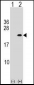 PLA2G12A Antibody (Center)