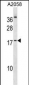 NHLH2 Antibody (Center)