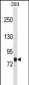 ACSL3 Antibody (C-term)