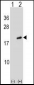 ARL2 Antibody (Center)